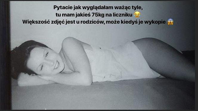 Blanka Lipińska, operacje plastyczne