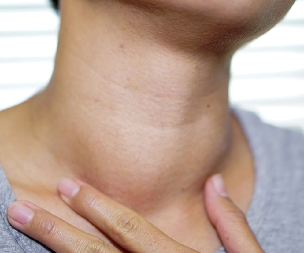 Tchawica - budowa, funkcje, choroby