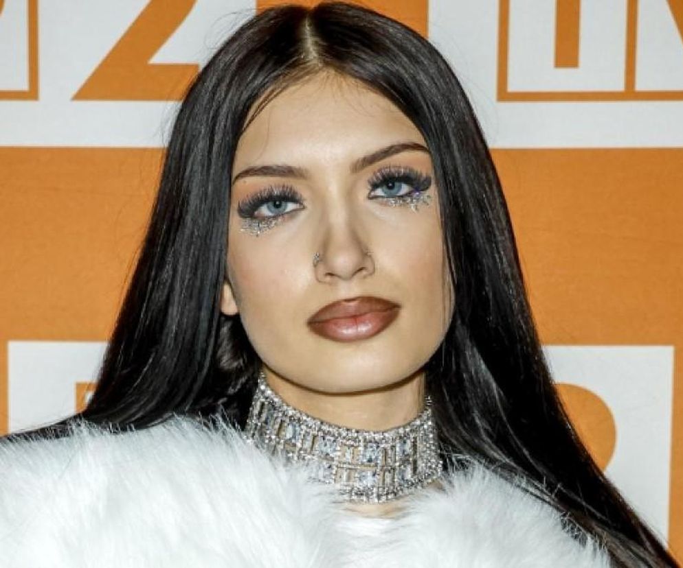 Viki Gabor powiększyła usta? Fani nie mają wątpliwości