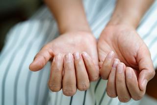 Choroby paznokci - co może być przyczyną problemów z paznokciami?