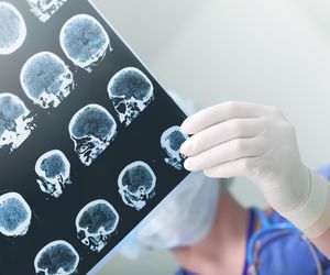 Zespół Lennoxa-Gastauta: dziecięcy zespół padaczkowy
