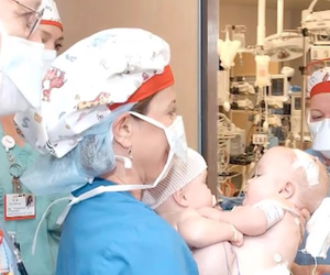 Urodziły się zrośnięte, matka oddała je tuż po porodzie. Dziś mają po 20 lat