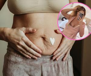 Pokazała, jak wygląda 11 dni po porodzie. Kochajcie swoje ciało na każdym etapie życia