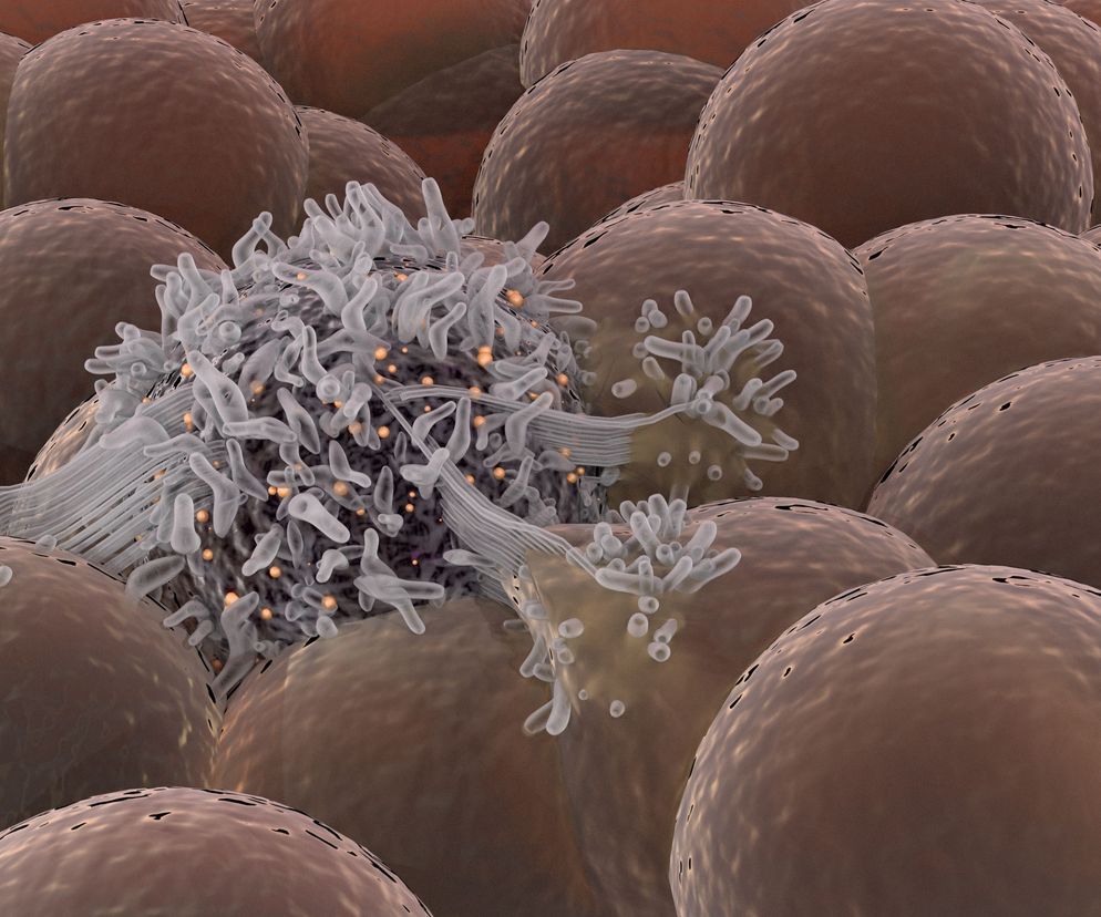 Nowotwory o nieznanym umiejscowieniu pierwotnym (CUP, Cancer of unknown primary) stanowią około 3 procent wszystkich nowotworów i są heterogenną grupą nowotworów o zróżnicowanym przebiegu klinicznym i rokowaniu.