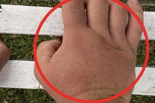 Pawła Kukiza pożądliły pszczoły 