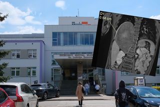 Wielki sukces lekarzy z Białegostoku! Usunęli gigantycznego guza z klatki piersiowej dziecka