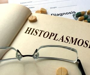 Histoplazmoza (choroba Darlinga): przyczyny, objawy,leczenie