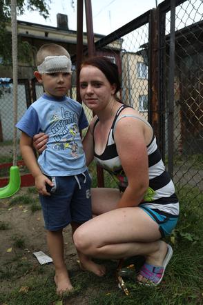 10- latek pociął nożem 5- latka