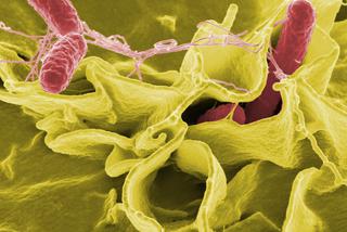Zabrze: Salmonella wykryta w żłobkach. Rośnie liczba zakażonych dzieci