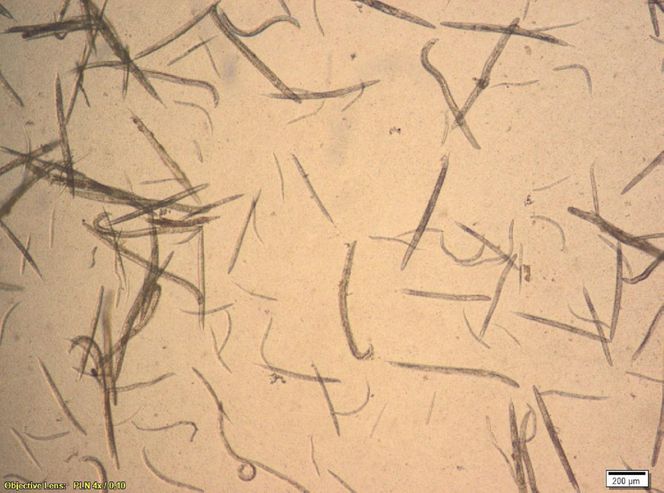 Nicienie z rodzaju Rhabditis po 24 godzinnej inkubacji z biopreparatem zawierającym niskocząsteczkowe metabolity wtórne (LMS) wyizolowane z kultur grzyba Cerrena