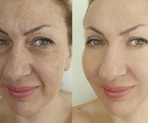 Kosztuje 1 zł, a daje efekt jak zabieg za 600 zł. Masz je w swojej lodówce