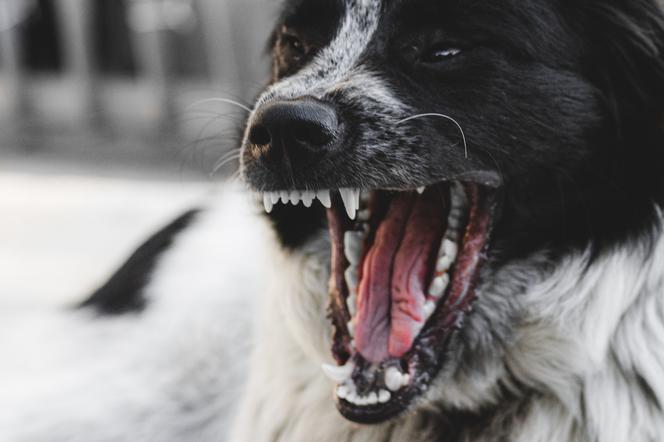 Agresywny pies wbił zęby w twarz młodej kobiety. Szokująca reakcja właścicielki! Jak tak mogła?!