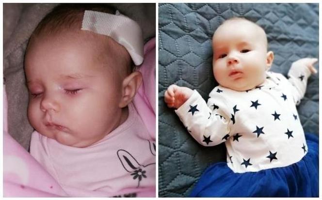 Czteromiesięczna Hania potrzebuje pomocy! Jest śmiertelne chora. Jedyna nadzieja w operacji