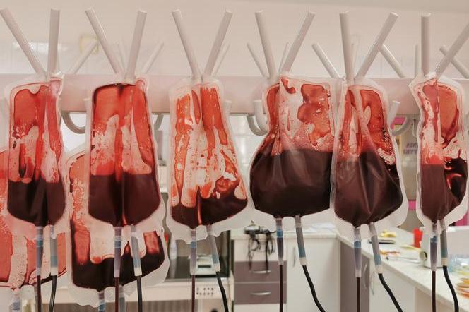 Radiator do napromieniowania krwi pojawił się w Regionalnym Centrum Krwiodawstwa i Krwiolecznictwa w Kaliszu 