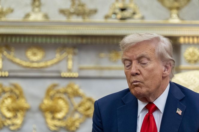 Donald Trump ma kłopoty ze zdrowiem. Nowe zdjęcia wywołały niepokój