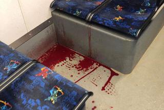 Kraków: Kałuża krwi w tramwaju? Szokujące zdjęcie internautki!