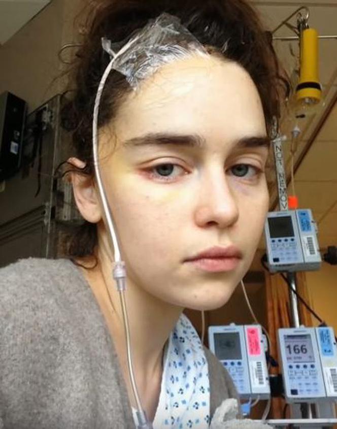 Emilia Clarke w szpitalu