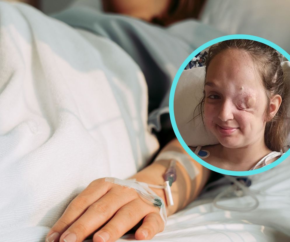 Miała na oku guzek, lekarz stwierdził, że nie ma czym się martwić. Zmarła z powodu rzadkiego nowotworu 