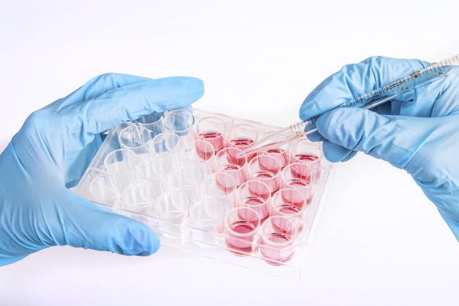 Badanie biochemiczne krwi: fosfor (P) - normy