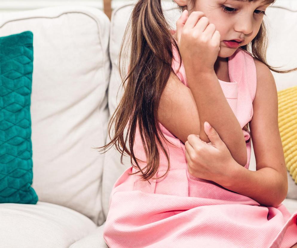 Objawy alergii pokarmowej u dziecka. Jak je rozpoznać?