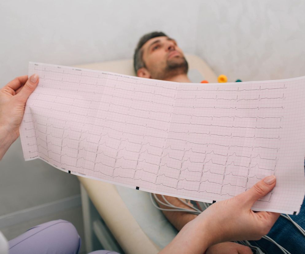 Czy AI zauważy u ciebie ukrytą wadę serca? Wynik EKG może ostrzec cię wcześniej