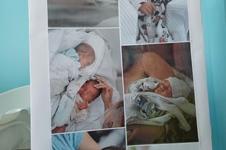 Oddział Ginekologiczno-Położniczy OCZ Ostrzeszów