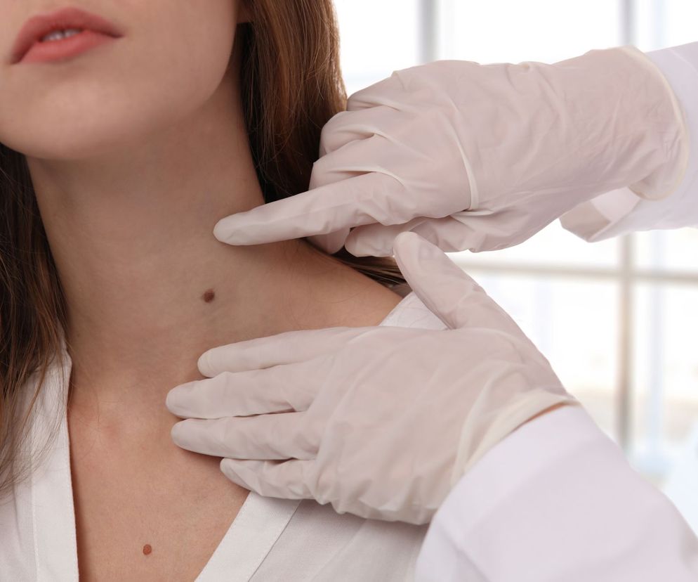 Porada dermatologa