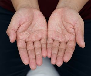 Zimne dłonie, swędzenie nadgarstków, kreski na paznokciach. O czym świadczą dolegliwości dłoni i rąk?