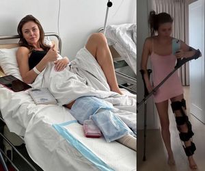 Obolała Joanna Opozda ma jeszcze siłę na fotki w lustrze. Nie przeszkodziły jej operacje i kule