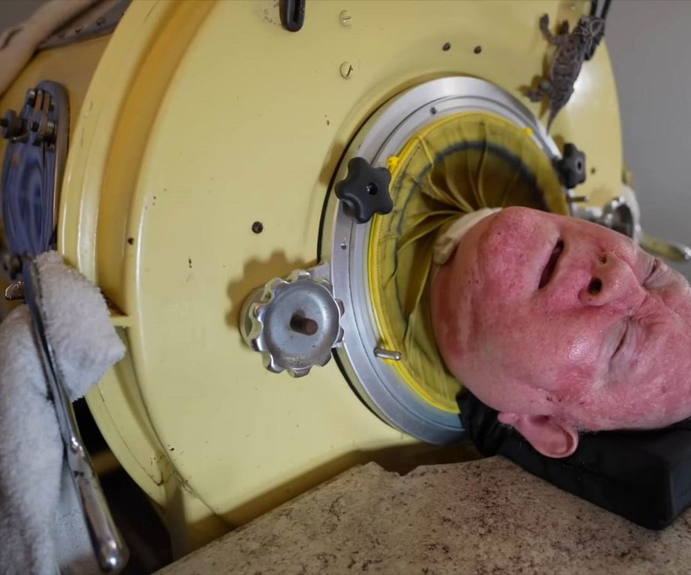 W żelaznym respiratorze żyje ponad 70 lat. Straciłem wszystko