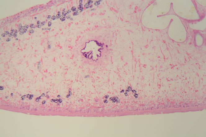 Motylica wątrobowa - objawy, leczenie i diagnostyka