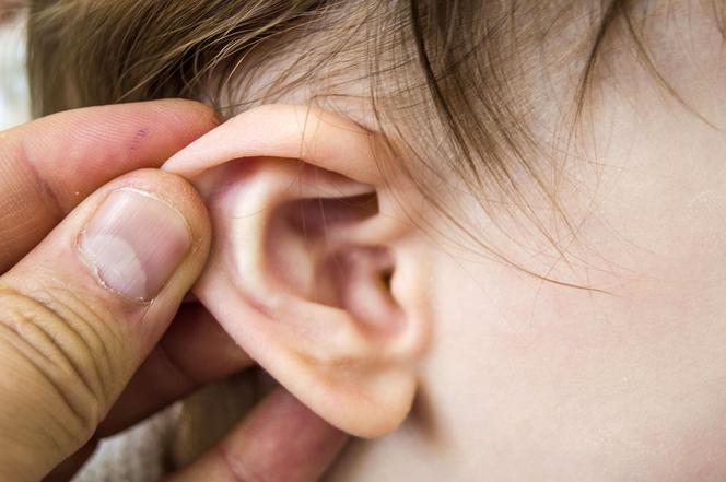 Uszy niemowlaka: MIT 4. Ciemna woskowina świadczy o problemach z uszami np.zapaleniu