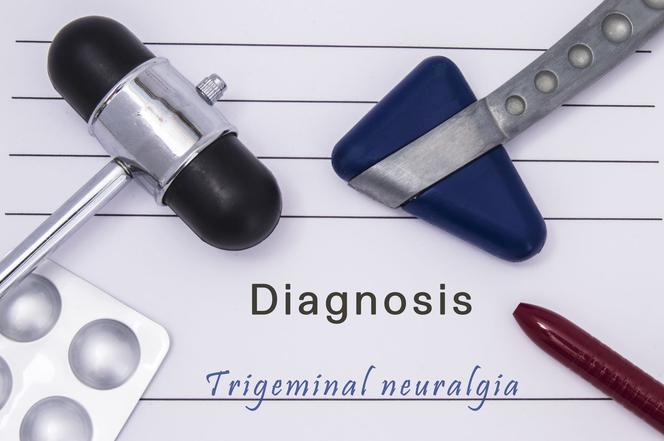 Neuralgia (nerwoból) nerwu trójdzielnego: przyczyny, objawy, leczenie