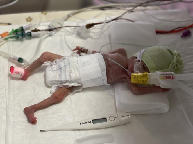 Ruda Śląska: Martusia urodziła się ważąc 390 gram. Po czterech miesiącach wychodzi do domu