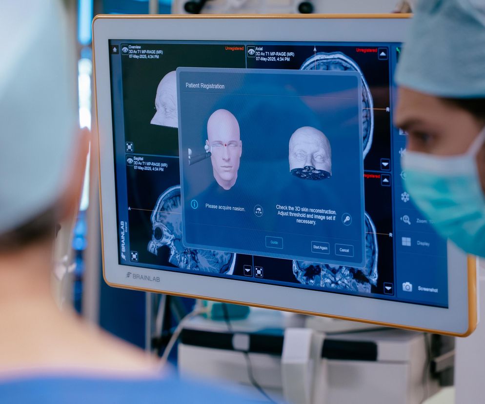 Operacja szansą na wyleczenie lekoopornej padaczki. Lubelscy lekarze stworzyli program diagnostyki i leczenia