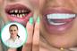 Z tureckimi zębami wracają do polskich stomatologów. Widzimy zęby opiłowane na zapałki