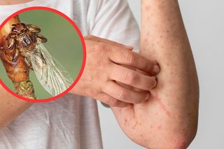 Latające kleszcze atakują chmarami. Boleśnie kąsają swoje ofiary 
