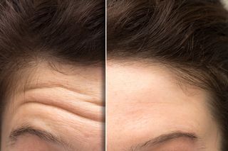 Gotuję, zalewam mlekiem i nakładam na twarz. Domowa maseczka na lwią zmarszczkę, która wyprasuje bruzdę. Zmniejsza zmarszczki i nawilża skórę