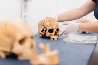 Dentyści z Katowic badają zęby wampirów z Gliwic