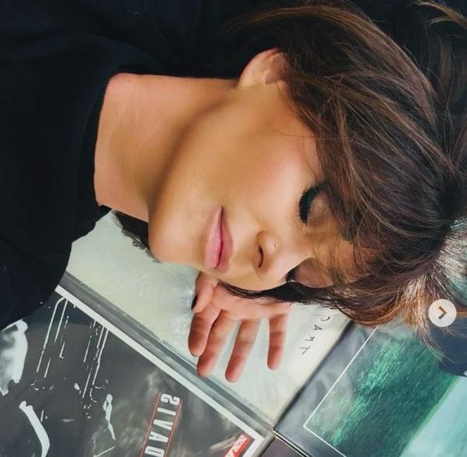 Katarzyna Skowrońska przeszła operację plastyczną