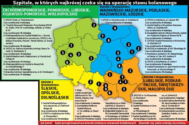 Wylecz kolano bez kolejki