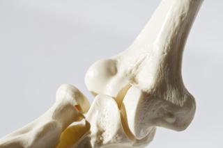 Osteoporoza u dzieci: przyczyny i leczenie