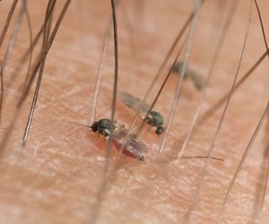 Uczulenie na jad meszek. Jak się objawia alergia na jad meszek?