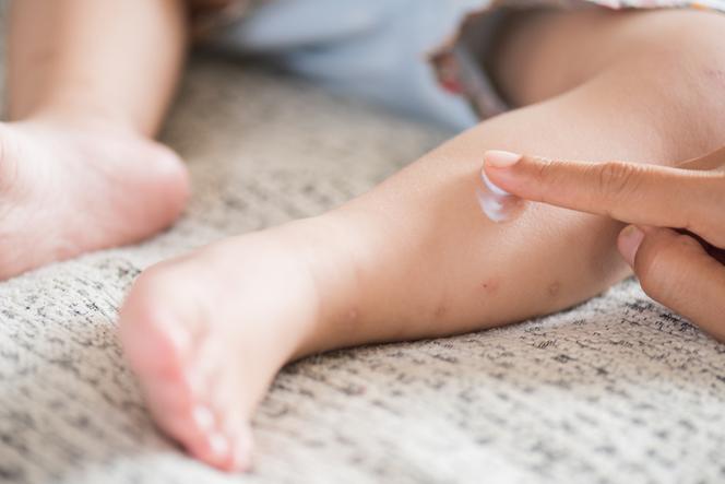 Pielęgnacja skóry atopowej u niemowląt