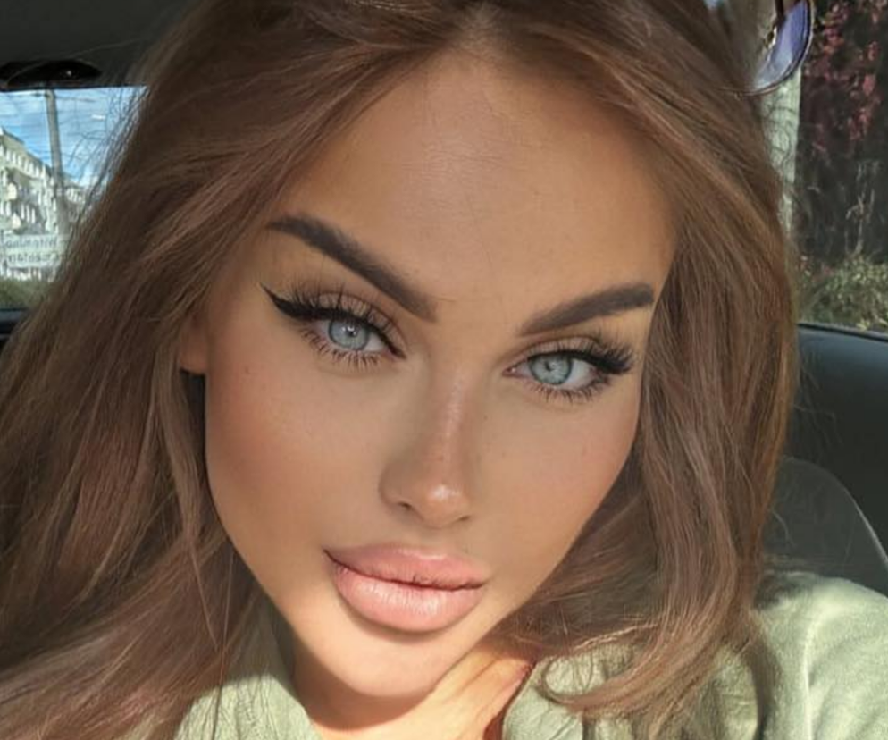 Ewel0na przeżyła horror po tureckich zabiegach. 