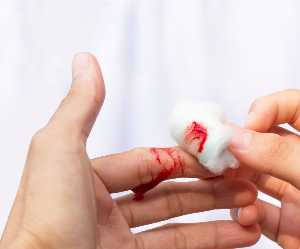 Hemostaza to z jednej strony utrzymanie krwi w postaci płynnej, a z drugiej - zapobieganie krwawieniom.