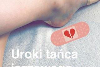 Julia Wróblewska pokazuje uraz na Instagramie
