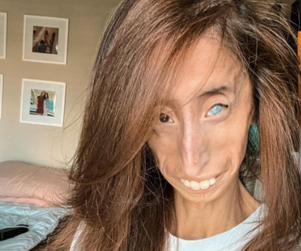 Lizzie Velásquez / Instagram