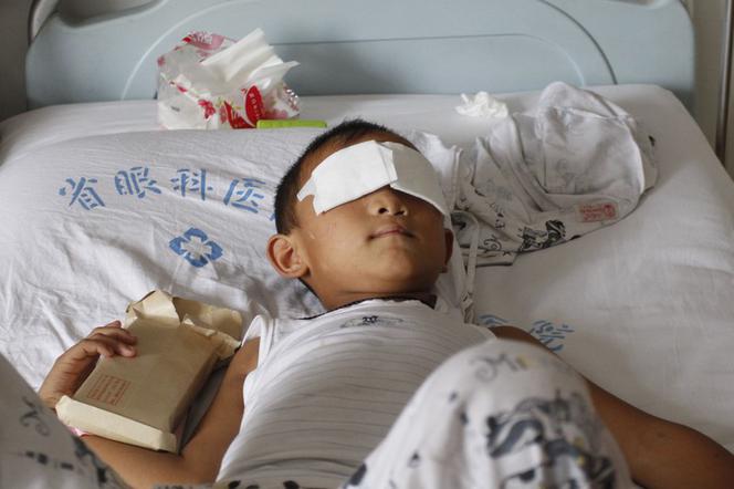 Chiny: Wiadomo kto wyłupił oczy 6-latkowi