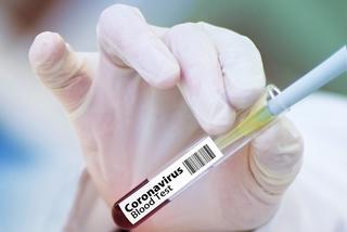 Oszustwa przy testach na koronawirusa. Pracownicy szpitala na Śląsku ujawniają skandaliczne praktyki